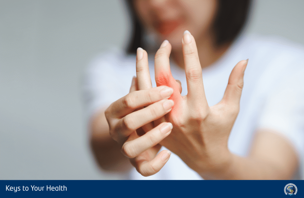 erw arthritis